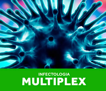 multiplex4 multiplex4